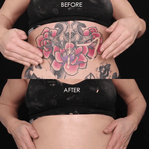 tattoos & birthmarks